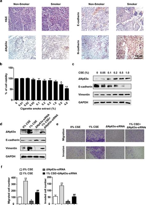 Δnp63α Regulates Ts Triggered Lung Cancer Emt A Hematoxylin And Eosin