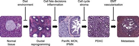 Genetically Engineered Mouse Models Of Pancreatic Cancer Unravelling Tumour Biology And