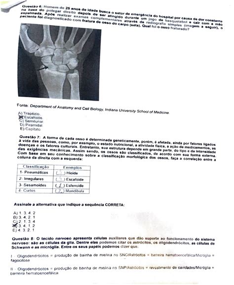 Provas De Anatomia Com Gabarito - Provas De Anatomia Com Gabarito - ZULEDU
