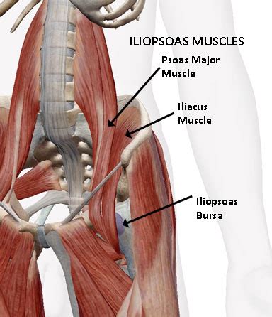 ILIOPSOAS BURSITIS - Coastal Virginia Spine & Pain Center