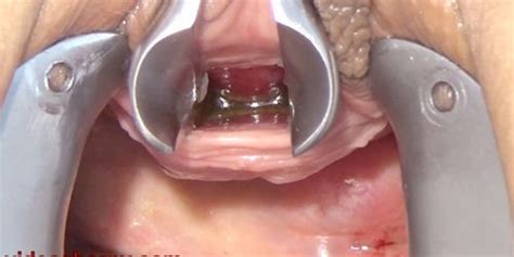 Mature Wife Masturbate Pee Hole With Brush And Chain Into Urethra Tnaflix