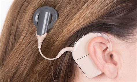 New Cochlear Implant Device Ensures Safety And Comfort In Kids During Mri