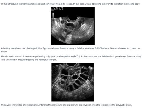 Solved In this ultrasound, the transvaginal probe has been | Chegg.com