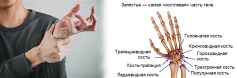 Немеют и болят кисти рук | Сеть клиник «ЗдравКлиник»