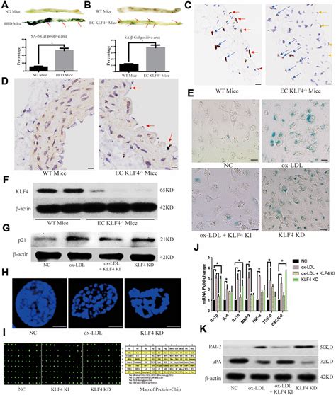 KLF4 Inhibited The Senescence Associated Secretory Phenotype In Ox LDL