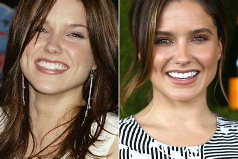 Celebrity Teeth Before & After: Teeth Whitening Makeovers Pictures 2017 ...