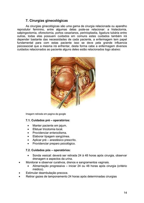 Cuidados De Enfermagem Pre E Pos Operatorios Pdf