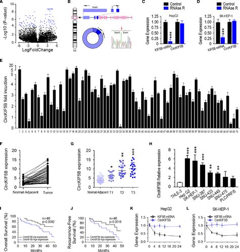 Figure 1 From CircKIF5B Promotes Hepatocellular Carcinoma Progression