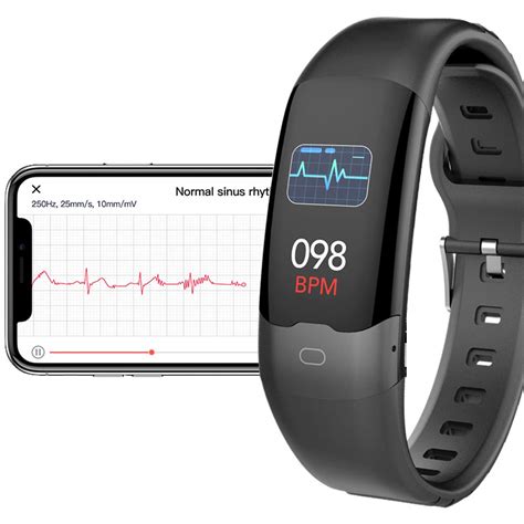 Buy Aupalla Ecg Watch With Chest Belt Portable Ecg Monitor Blood