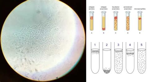 Obligate Anaerobes - Definition, Identification, Mechanism, Uses ...