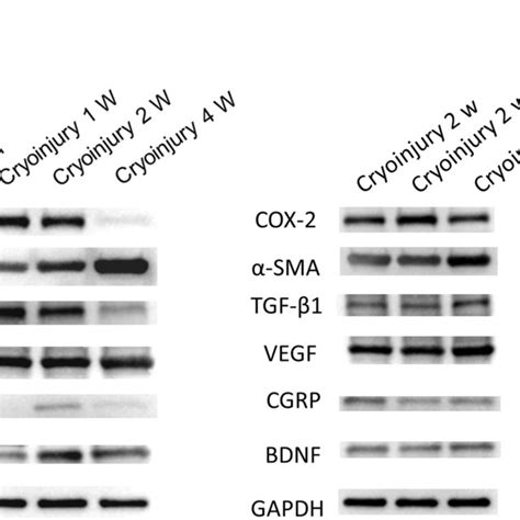 Western Blot For Sma Cox Tgf Vegf Cgrp Bdnf Protein