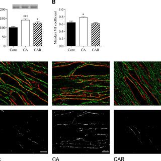 Myocardial Expression And Subcellular Distribution Of Adrenergic