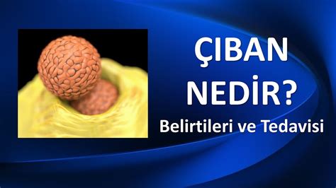 Iban Ned R Belirtileri Ve Tedavisi Youtube