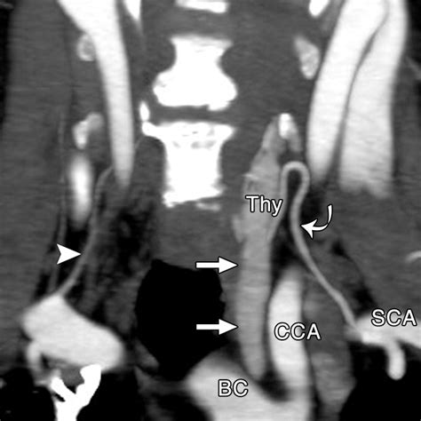 How To Perform Parathyroid D Ct Tips And Traps For Technique And