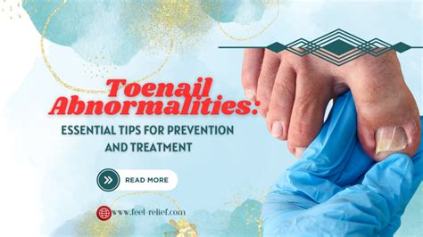 Toenail Abnormalities: Essential Tips for Prevention and Treatment ...