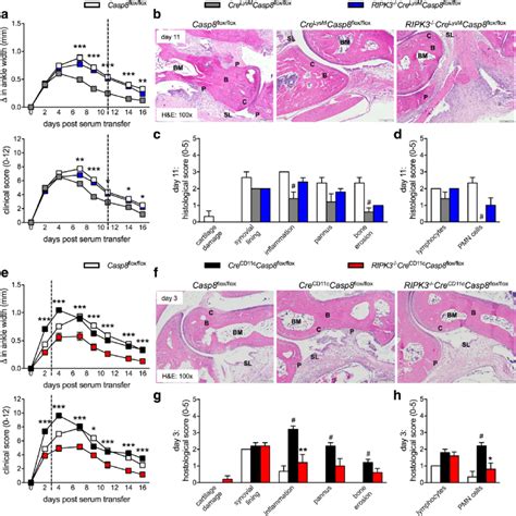 Receptor Interacting Serine Threonine Kinase Ripk Signaling