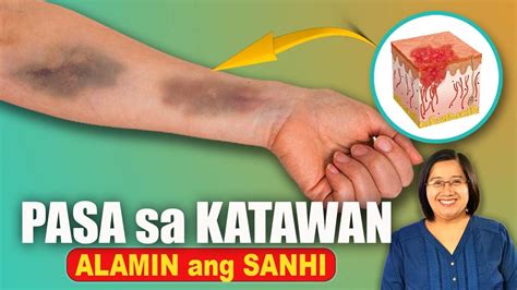 Pasa Sa Katawan Alamin Ang Sanhi At Paano Iiwasan Tagalog Health