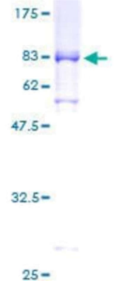 Novus Biologicals Recombinant Human Cyclin A1 GST N Term Protein 25