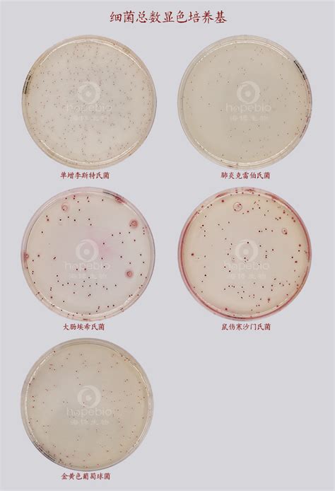 细菌总数显色培养基 微生物图片 青岛海博生物