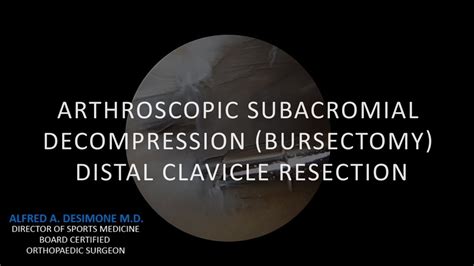 Arthroscopic Subacromial Decompression Bursectomy Distal Clavicle