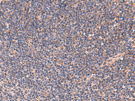 Tnf Anti Tnf Rabbit Polyclonal Antibody