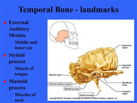 Ppt The Skeleton Powerpoint Presentation Free Download Id176647