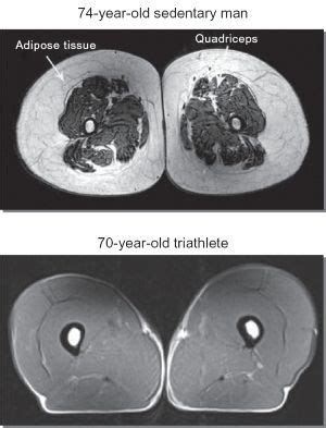 Las mioquinas y el ejercicio físico — Salud y Bienestar — Sott.net