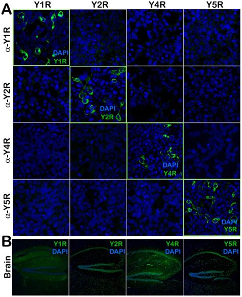 A Immunofluorescence If Analysis Of 293 Hek Cells Expressing Murine Download Scientific