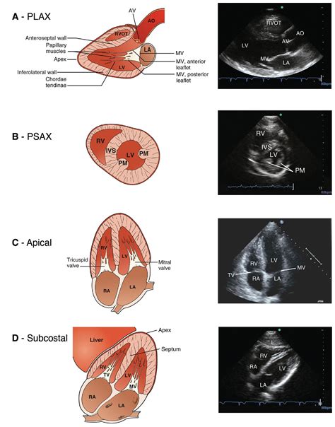 Point Of Care Ultrasound Clinical Tree