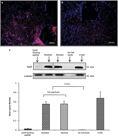 The Expression Of Erythropoietin Receptor EpoR In Skeletal Myotubes