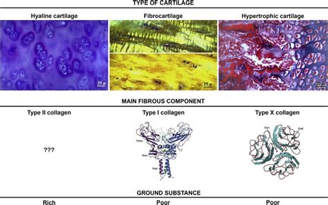 Hyaline Fibro And Hypertrophic Cartilage At A Glance The Fibrillar