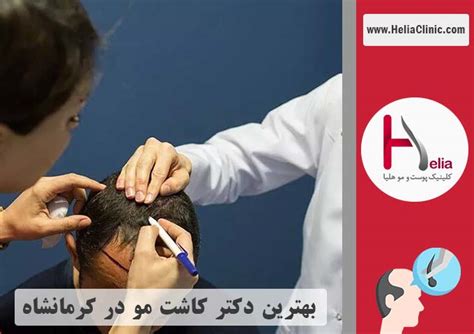 کاشت مو در کرمانشاه مشخصات بهترین دکتر و کلینیک هزینه تقریبی