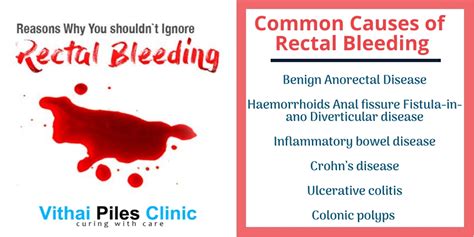 Rectal Bleeding Symptoms Causes Treatments - Bank2home.com