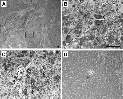 Potential Interaction Between Ccr1 And Its Ligand Ccl3 Induced By