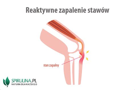 Reaktywne zapalenie stawów algi Spirulina i Chlorella