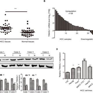 Tinagl Is Upregulated In Hcc Samples And Hcc Cell Lines Notes A And