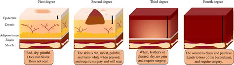 Current Challenges And Future Applications Of Antibacterial