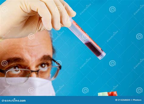 Laboratory Technician Holding A Hand With Blood Sample Stock Photo