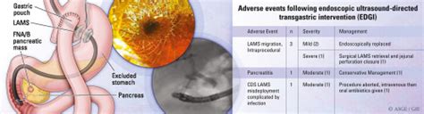 Eus Directed Transgastric Interventions In Roux En Y Gastric Bypass