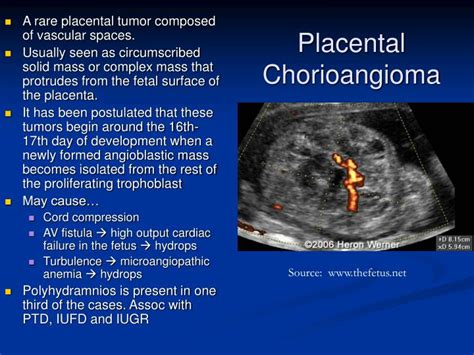 Ppt Placental Us Powerpoint Presentation Id3356735