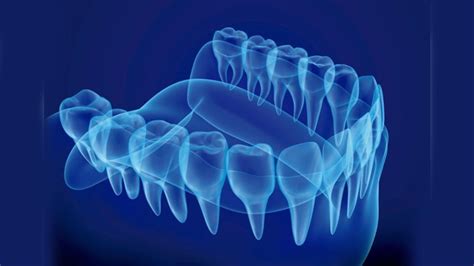 Odontología Digital En Qué Consiste Y Qué Ventajas Ofrece