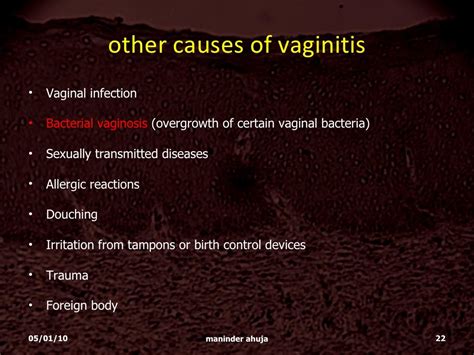 Atrophic Vaginitis Under Treated Under Diagnosed F