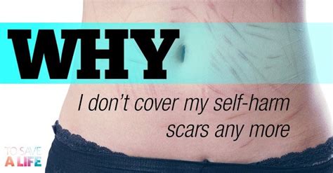 Why I Don T Cover My Self Harm Scars Any More To Save A Life