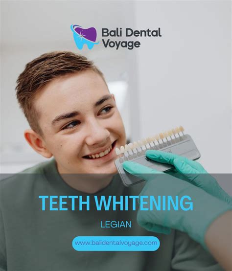 Teeth Whitening Bali Legian Teeth Whitening Legian