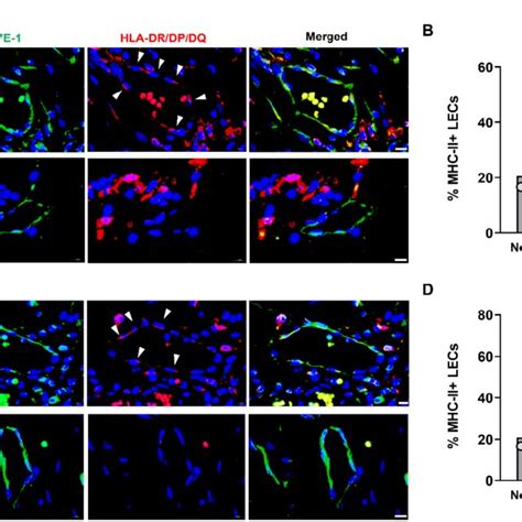 Ifn Induces Upregulation Of Mhcii In Lecs In Vitro And In Vivo In The