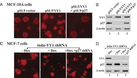 Effects Of YY1 And P27 Expression On The Morphology Of Breast Cells In