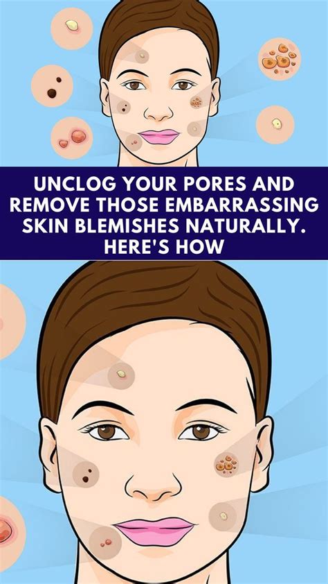 How To Unclog Your Pores Artofit