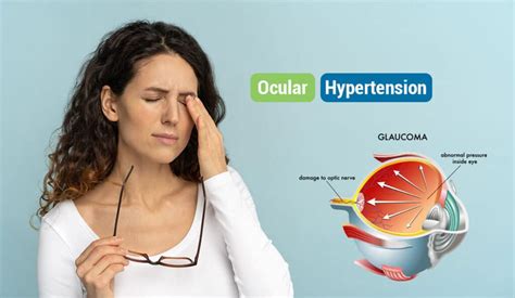 Ocular Hypertension: Symptoms, Causes, Prevention, Risk Factors