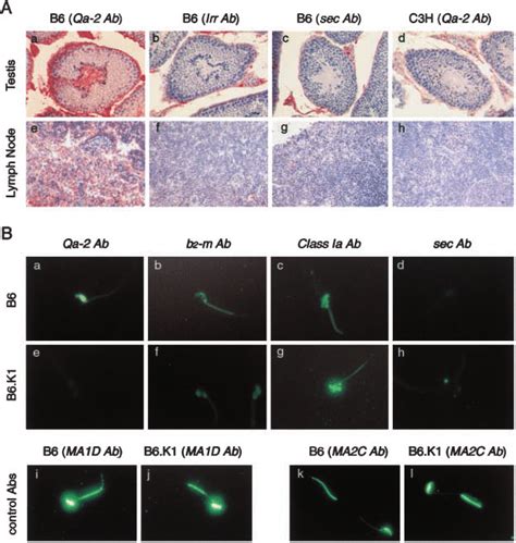 Ab Qa 2 Expression In Testis And Sperm A Detection Of Qa 2 Expression Download Scientific