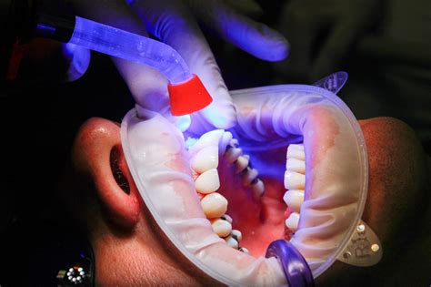 Free Images Jaw Mouth Organ Dentistry Hand Health Care Finger